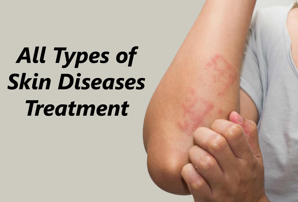 Skin Diseases