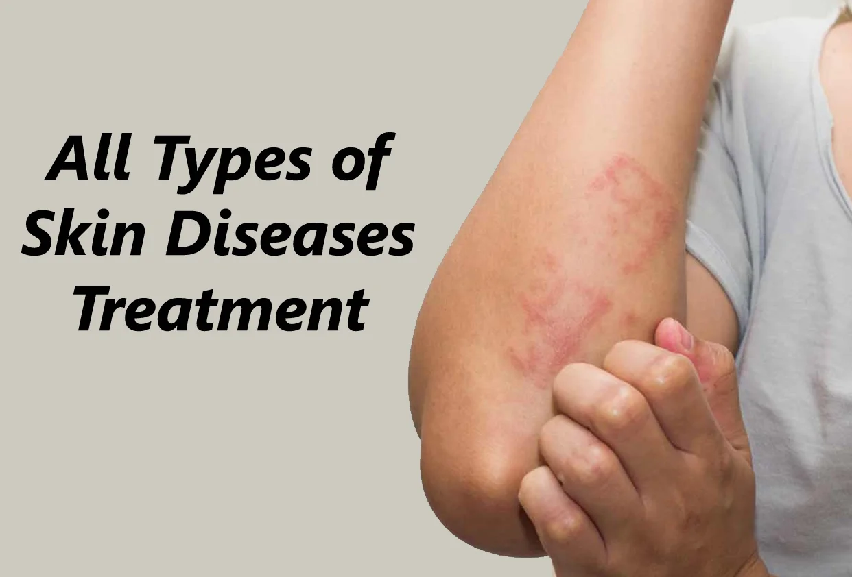 Skin Diseases
