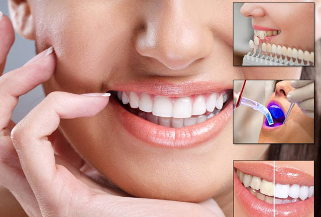Cosmetic Dental Treatment