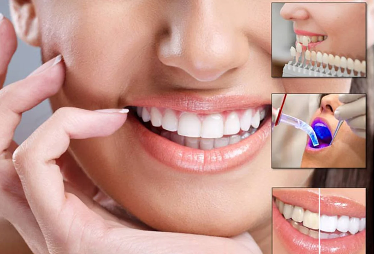 Cosmetic Dental Treatment