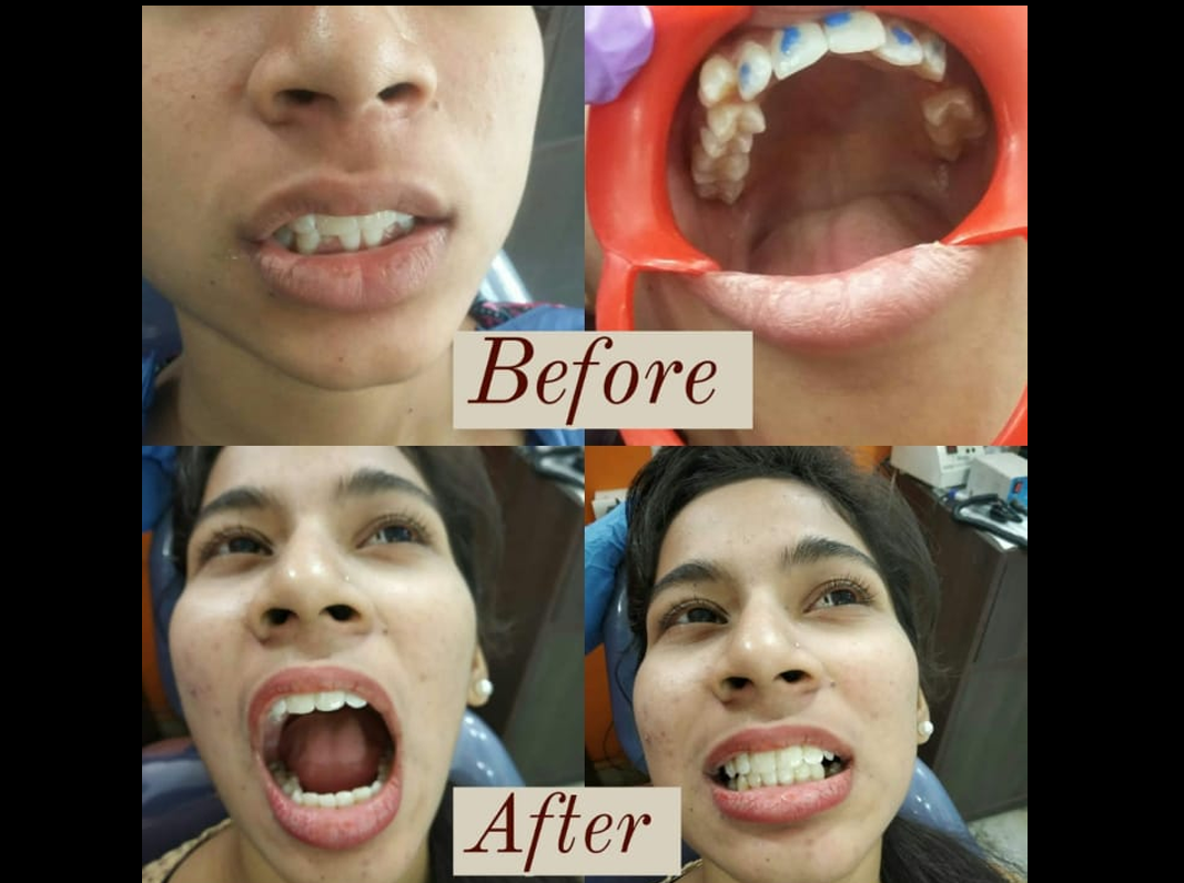 Ortho Treatment