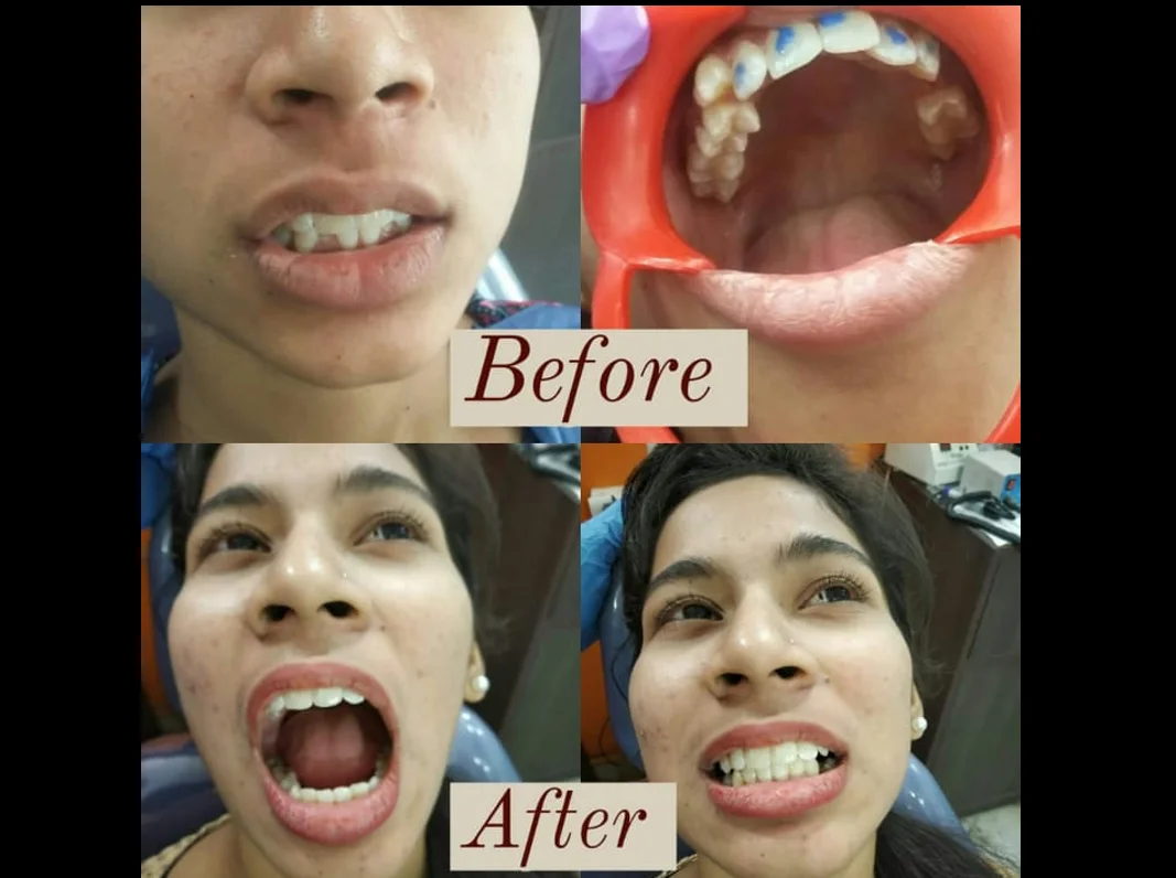 Ortho Treatment